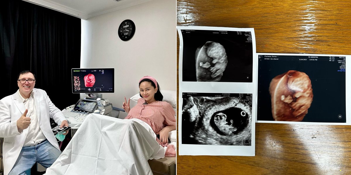 Denise Chariesta's Latest Photos That Are Being Criticized for Being Proud of Pregnancy Outside of Marriage, Often Showing Ultrasound Photos