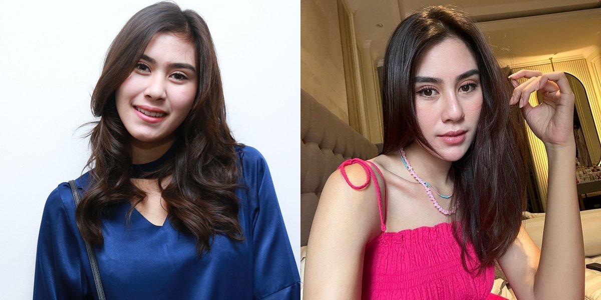 Many Accused of Plastic Surgery, Syahnaz Sadiqah's Transformation Portraits - Nose and Lips Called Strange by Netizens