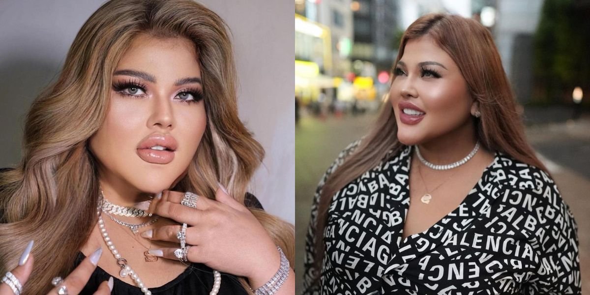 Formerly Known as Obese, Here are 8 Latest Photos of Shindy Samuel after Gastric Bypass Surgery - Even More Praised for Her Beauty by Netizens