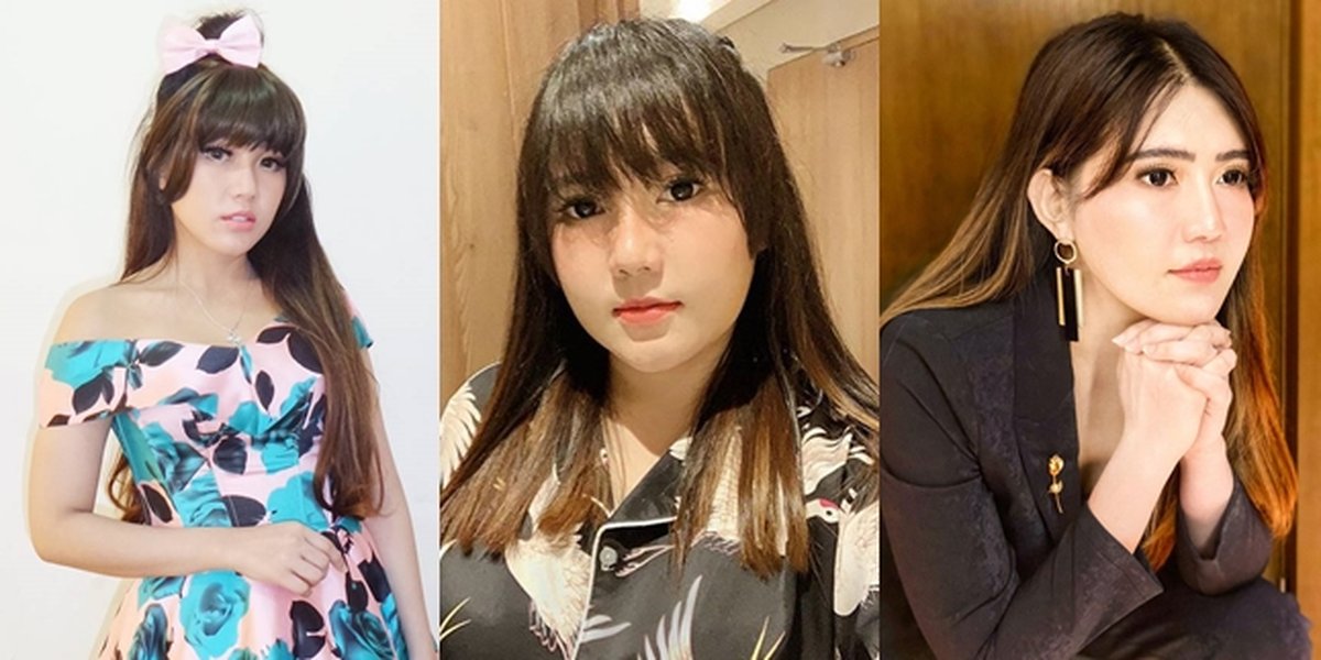 Once Accused of Plastic Surgery, Peek at Via Vallen's Transformation Photos that Make Her More Beautiful and Stunning - Pointed Chin Becomes the Highlight
