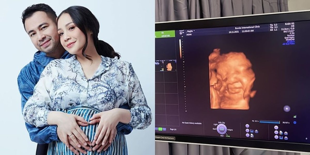 Smiling Inside the Womb, Series of Ultrasound Photos of Nagita Slavina and Raffi Ahmad's Future Child Who Will Be Born Soon: Flooded with Good Wishes From Netizens