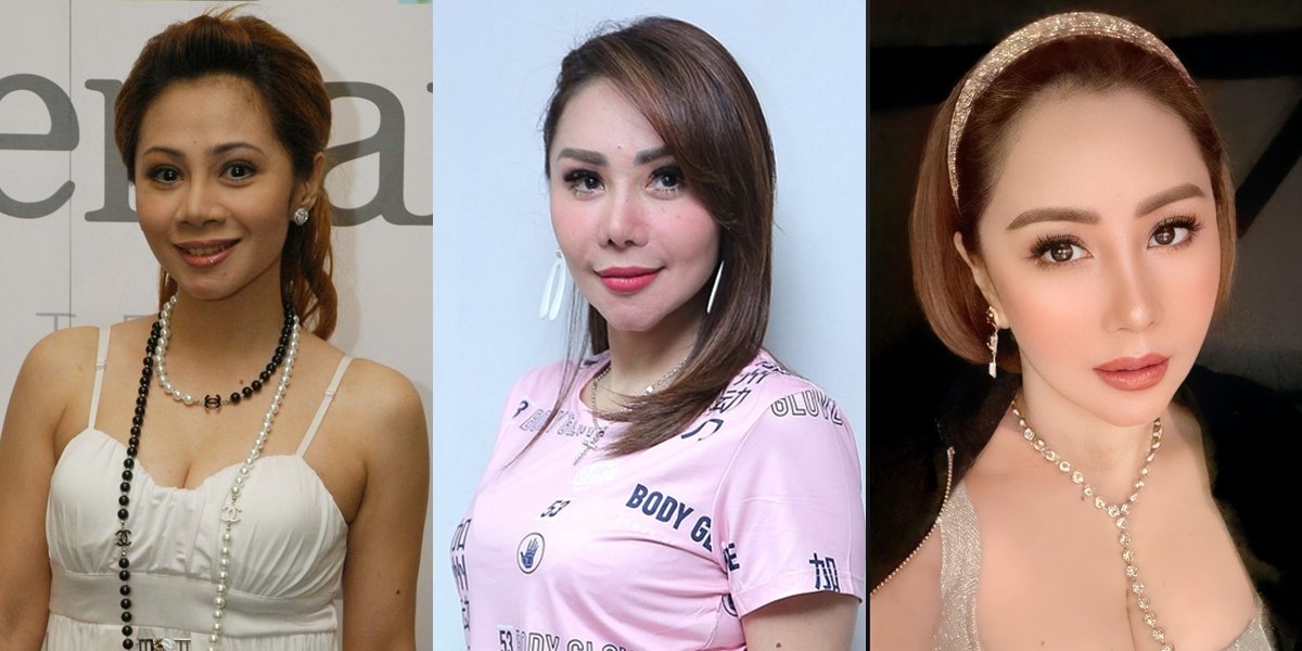 Almost 50 Years Old, Femmy Permatasari's Transformation Photos that are Making Everyone Amazed and Look Younger - No Hesitation to Admit Plastic Surgery