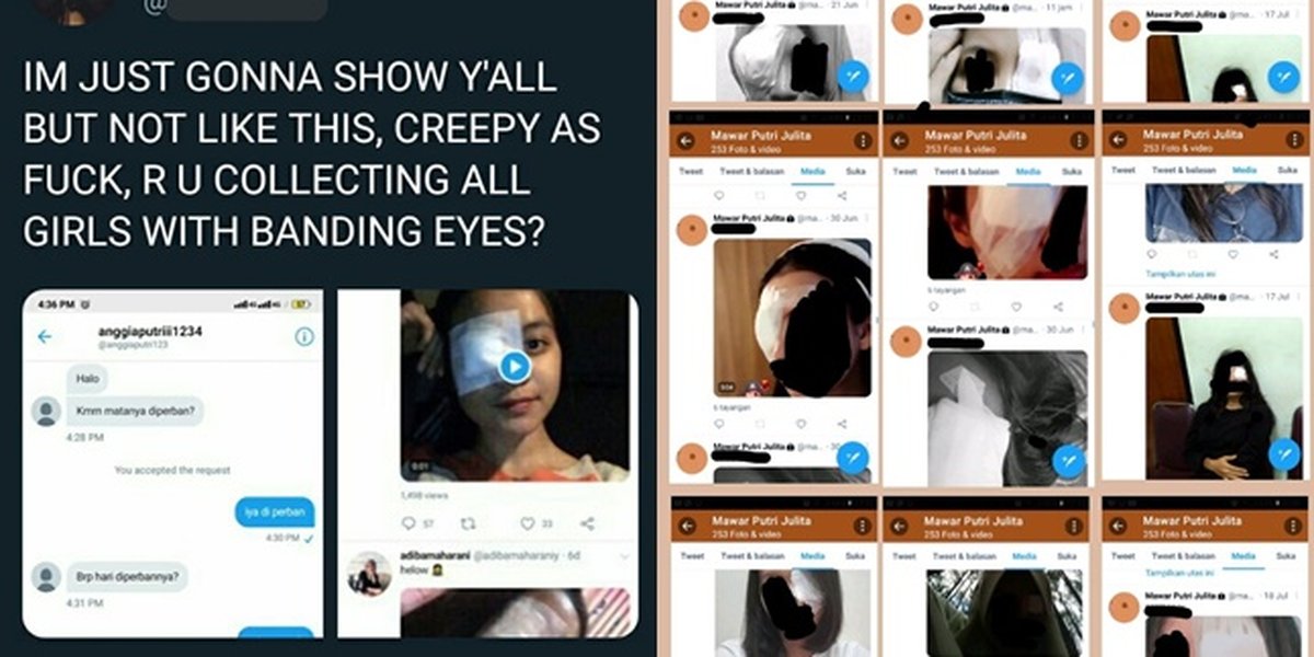 Viral Fetish Photo of Women with Bandaged Eyes, This is the Perpetrator's Modus Operandi on Social Media