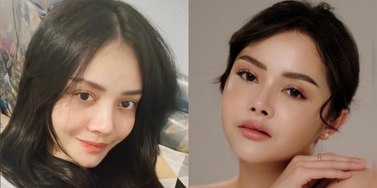 His Face and Nose Were Once Called Strange, Here are 8 Latest Portraits of Mawar AFI Who Looks Even More Beautiful Like a Teenager - Netizens Say Someone Regrets It