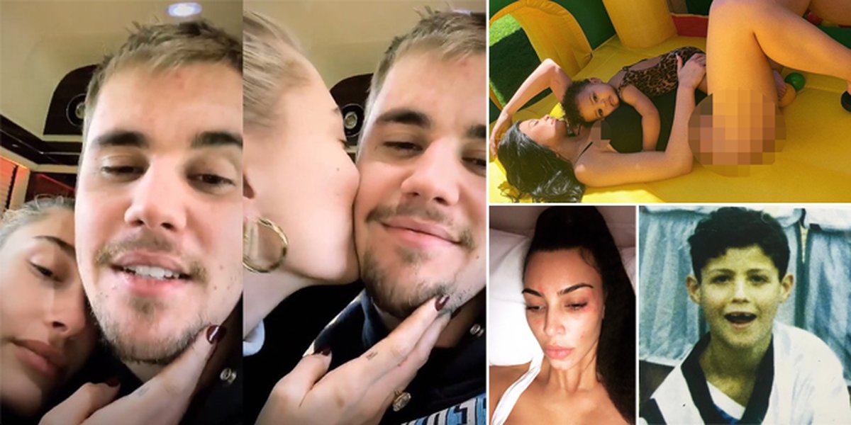 Weekly Hot: Justin Bieber's Intimate Photo - Kim Kardashian's Psoriasis