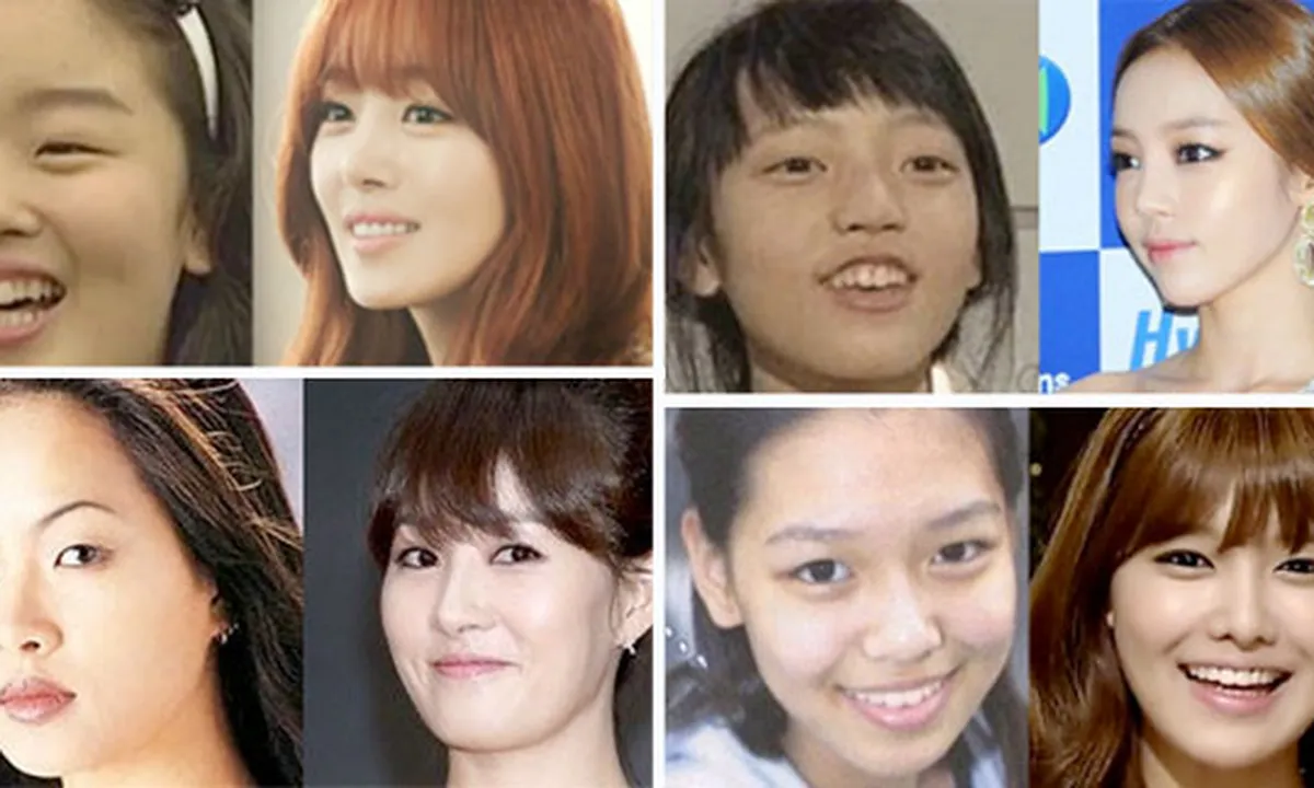 10 Foto Masa Lalu Seleb Korea Yang Berubah Drastis!