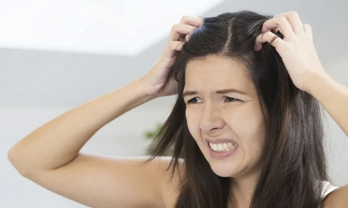 11 Cara Menghilangkan Kutu Rambut dan Telurnya Secara Alami, Ampuh dan Nggak Ribet