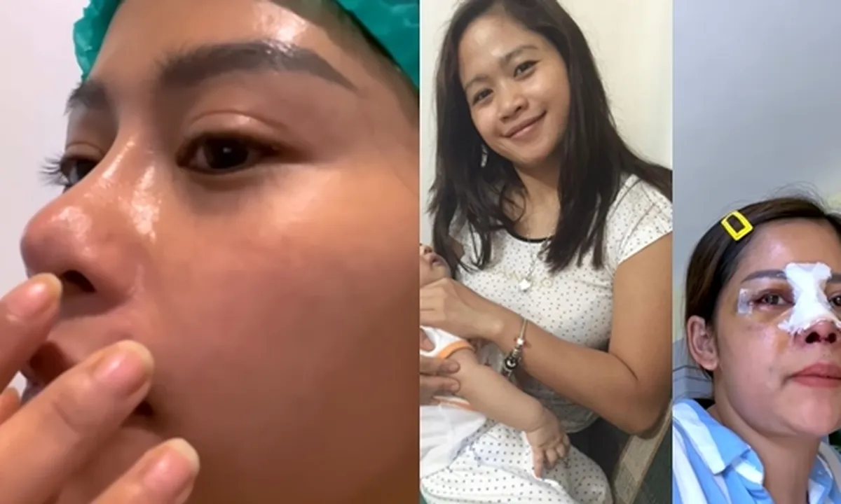 3 Kali Oplas, 11 Potret Transformasi Farida Nurhan yang Kini Kinclong - Sempat Dihujat dan Disebut Mirip Michael Jackson