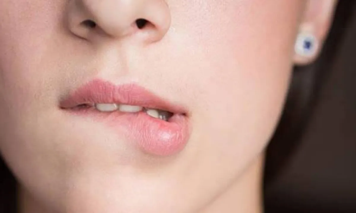 5 Cara Mudah Menjaga Bibir Agar Merah Alami