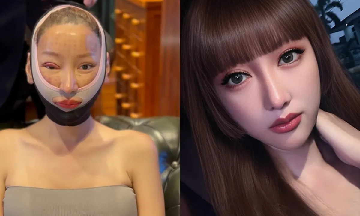 7 Potret Paling Terbaru Lucinta Luna Setelah Oplas Lagi, Super Manglingi