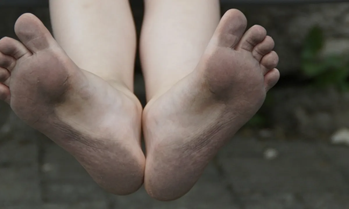 8 Cara Menghaluskan Tumit Kaki yang Kasar dan Pecah-Pecah Secara Alami