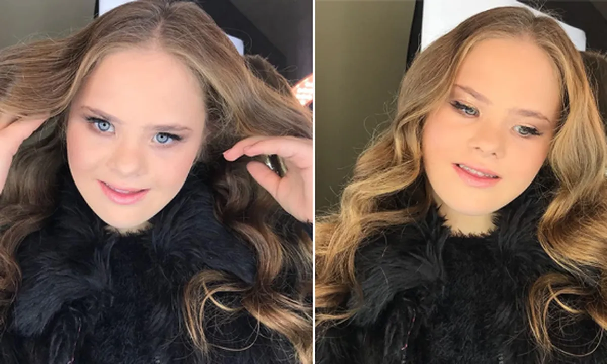 Alami Down Syndrome, Remaja Cantik Ini Jadi Model Hingga Dikontrak 5 Agensi