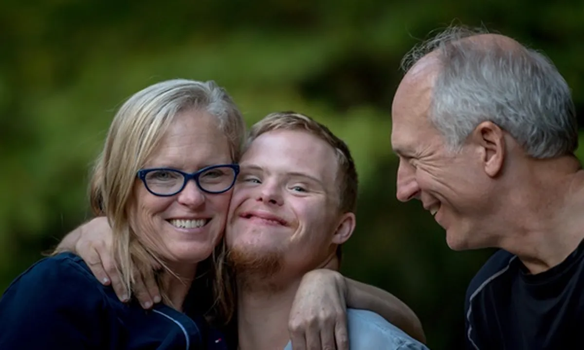 Apa Arti Down Syndrome? Pahami Penjelasan Gejala dan Pengobatannya