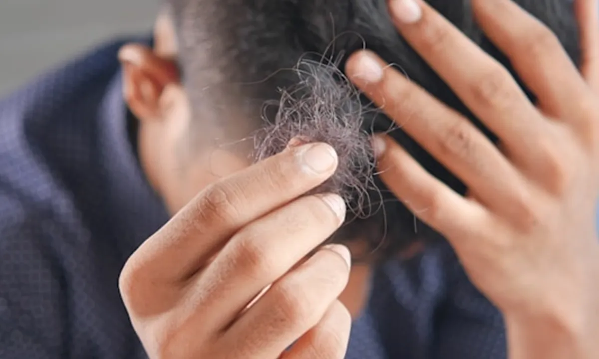 Arti Mimpi Rambut Rontok Banyak: Simbol Perubahan dan Kecemasan