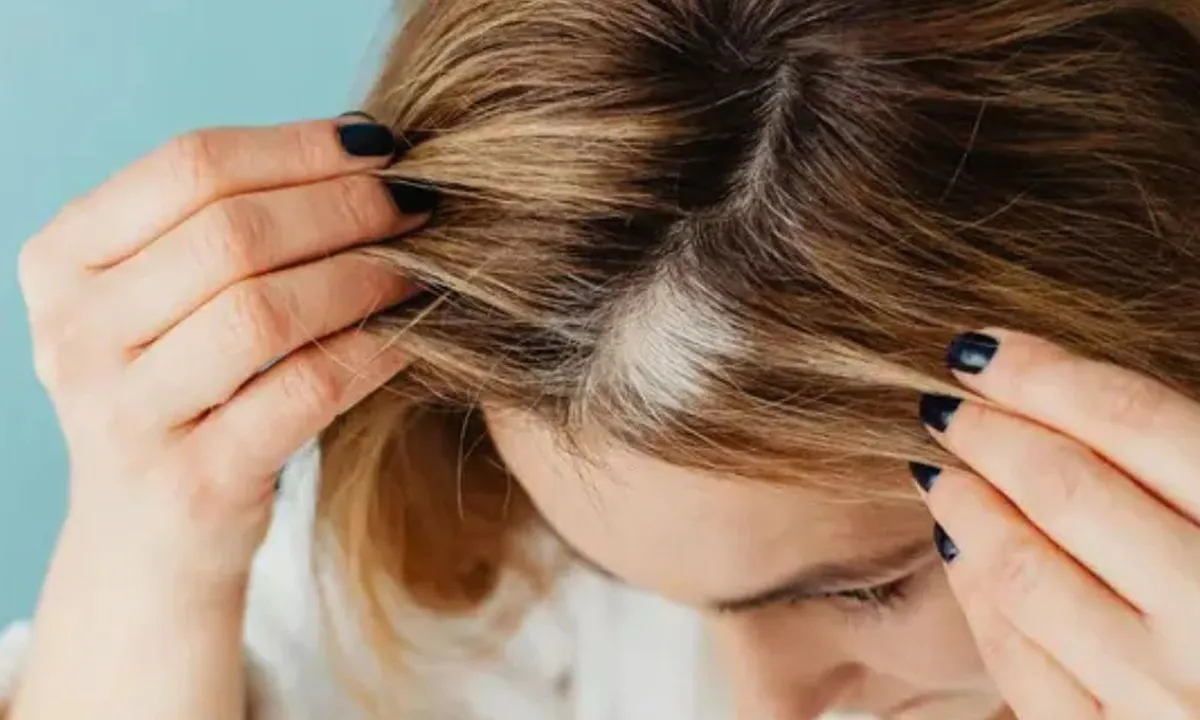 Cara Mengatasi Rambut Pitak dengan Trik Makeup Sederhana, Auto Percaya Diri