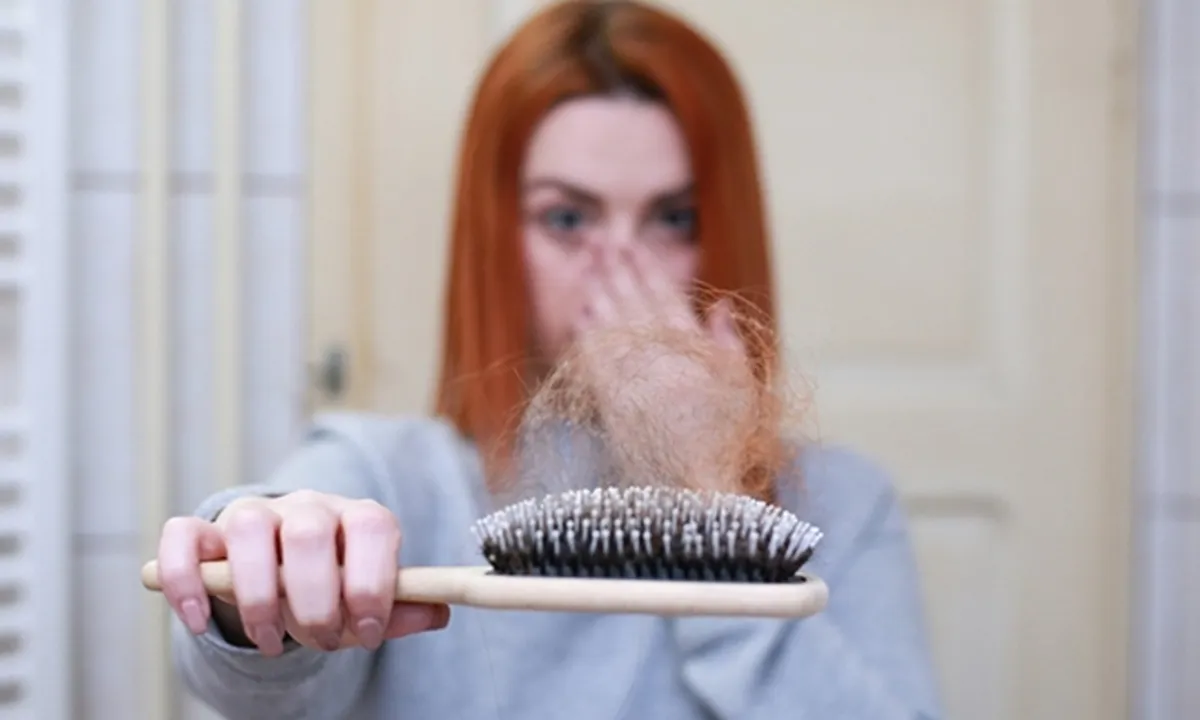 Cara Mengatasi Rambut Rontok Bagi Wanita Berhijab Secara Alami