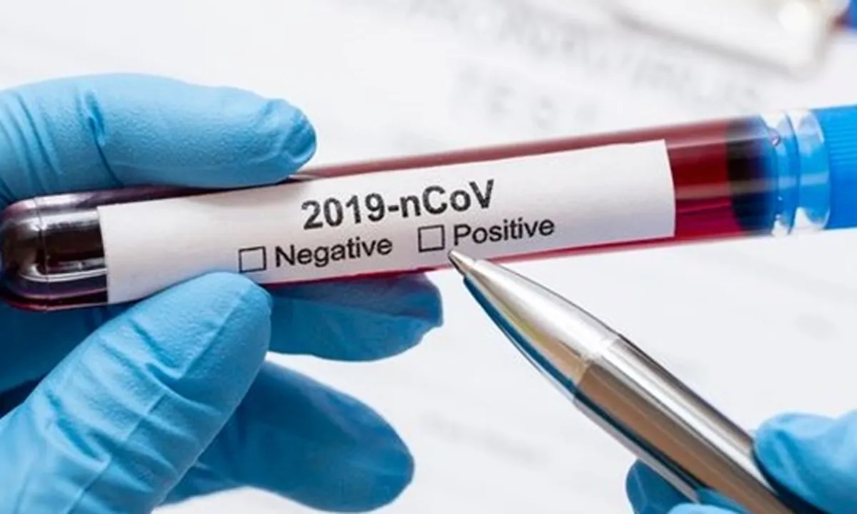 Dapatkah Orang yang Terkena Virus Corona Covid-19 Terinfeksi Kembali?