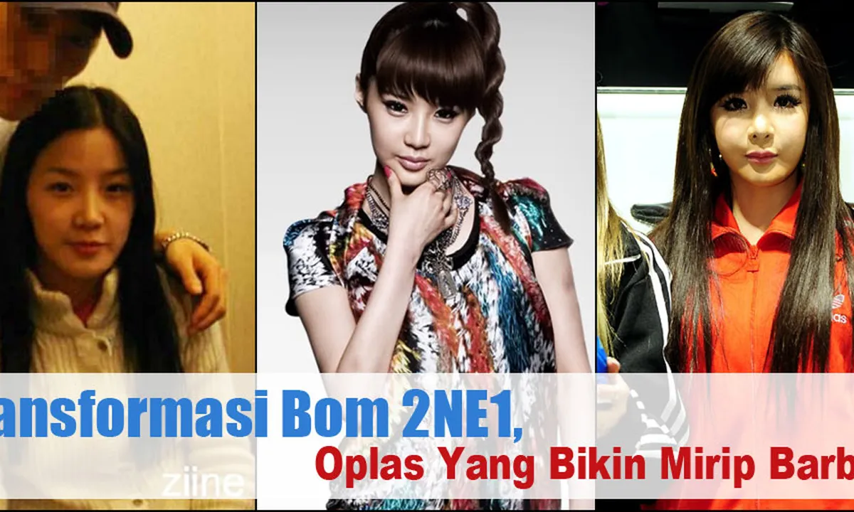 Demi Wajah Mirip Barbie, Bom 2NE1 Oplas?