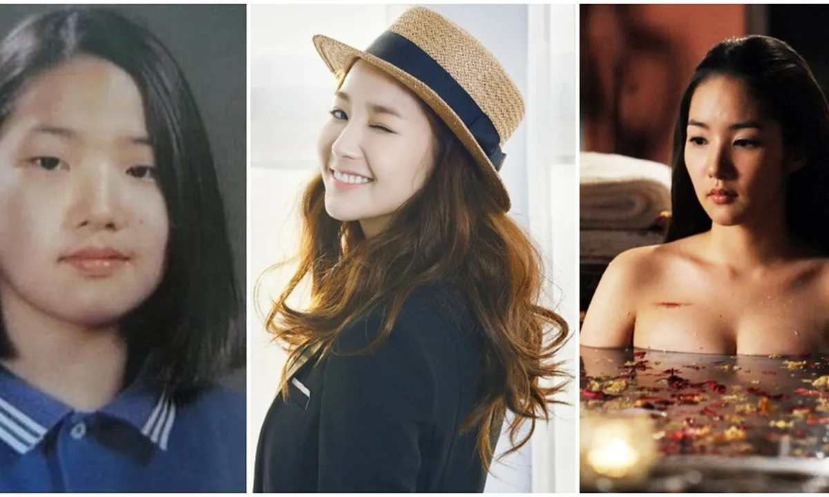 Transformasi Park Min Young, Mantan Lee Min Ho Yang Akui Oplas