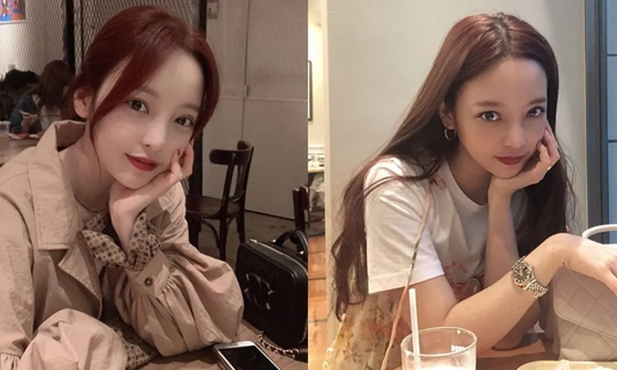 Goo Hara Dikabarkan Telah Siuman, Ucapkan Permintaan Maaf