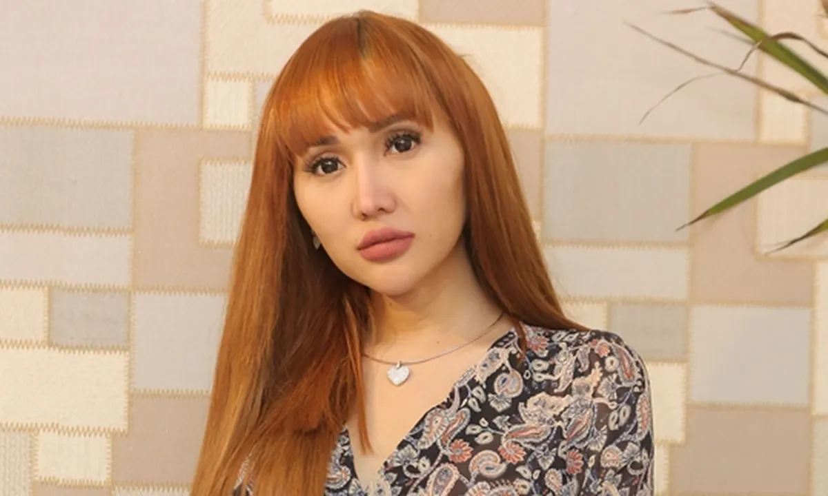 Oplas dari Ujung Rambut sampai Kaki, Lucinta Luna Habiskan Uang Miliaran