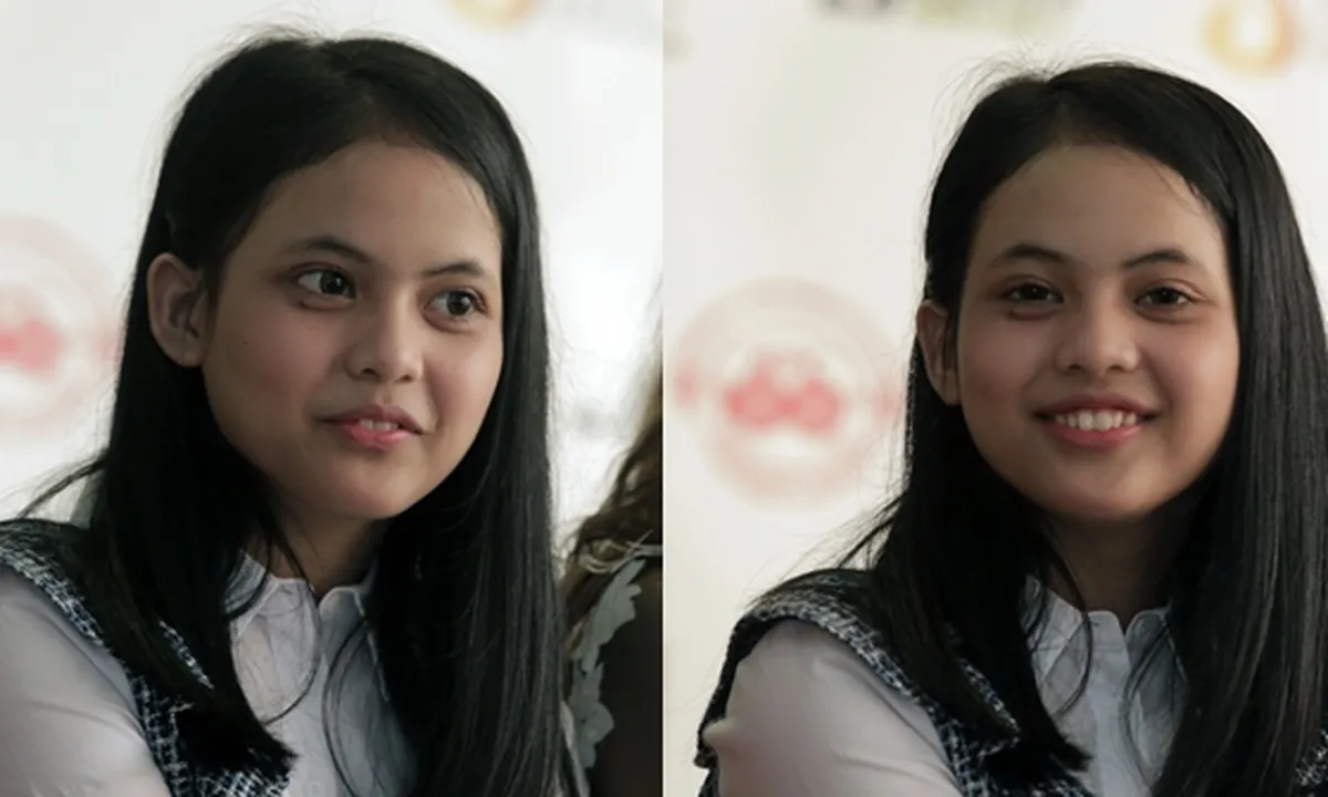 Pipi Memar Ketiban Handphone, Putri DA4 Tetap Sibuk Syuting FTV