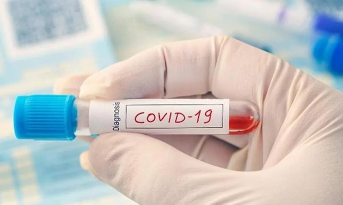 Positif Covid-19 Diduga Setelah Semeja di Hajatan Khitanan