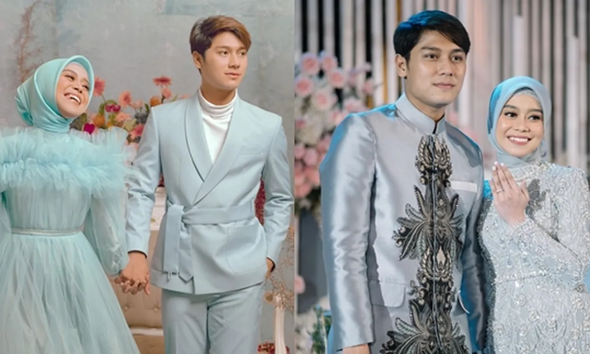 Rizky Billar Jalani Terapi Kaki Setelah Acara Lamaran dengan Lesti Kejora