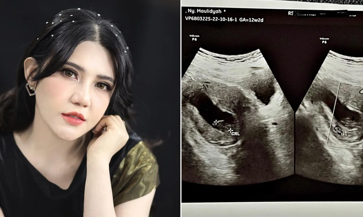 Sedih, Via Vallen Kembali Curhat Soal Janin yang Tak Berkembang