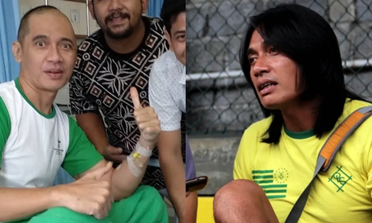 Seputar Glioblastoma, Kanker Otak Yang Diderita Agung Hercules