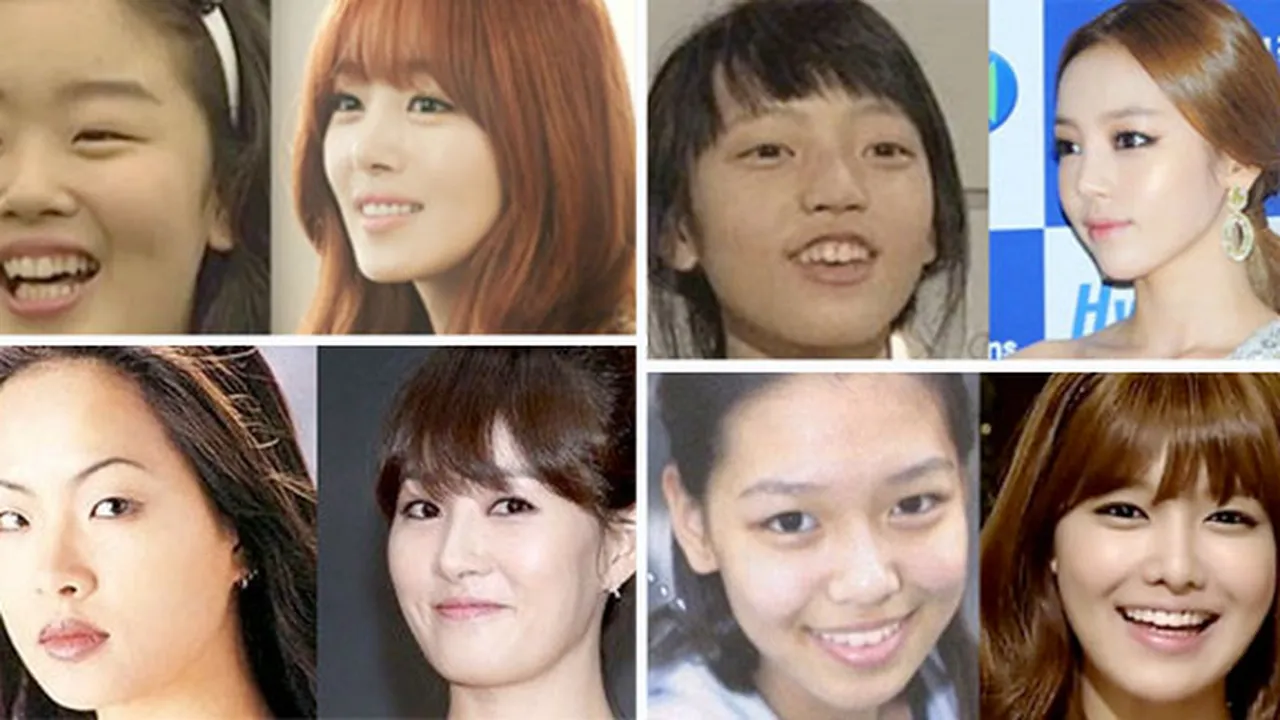 10 Foto Masa Lalu Seleb Korea Yang Berubah Drastis!