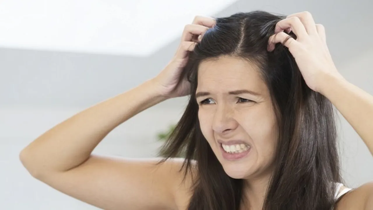 11 Cara Menghilangkan Kutu Rambut dan Telurnya Secara Alami, Ampuh dan Nggak Ribet