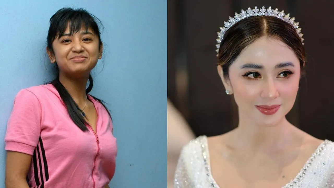 11 Transformasi Artis Setelah Tanam Benang, Ada yang Langsung Mirip Idol Korea