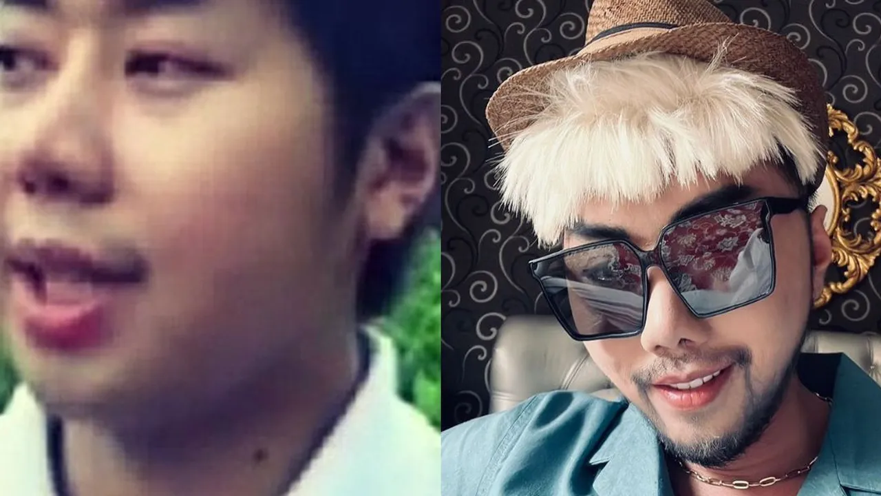 13 Transformasi Artis yang Lakukan Treatment Dagu Lancip, Before Afternya Bikin Kaget