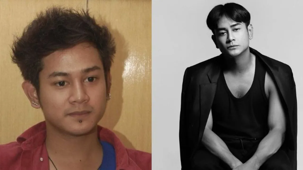 15 Transformasi Artis Sebelum dan Sesudah Suntik Botoks, Ada yang Menolak Tua