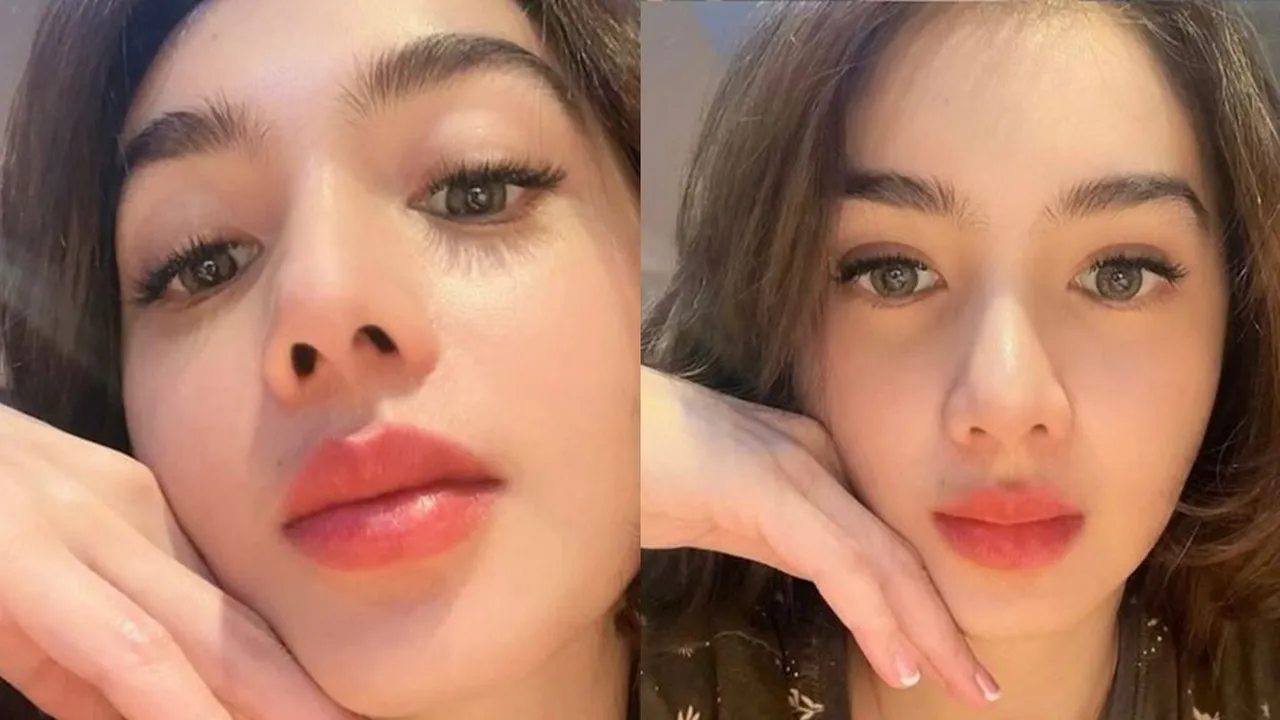 2 Bulan Setelah Oplas, Begini Potret Terbaru Angel Karamoy
