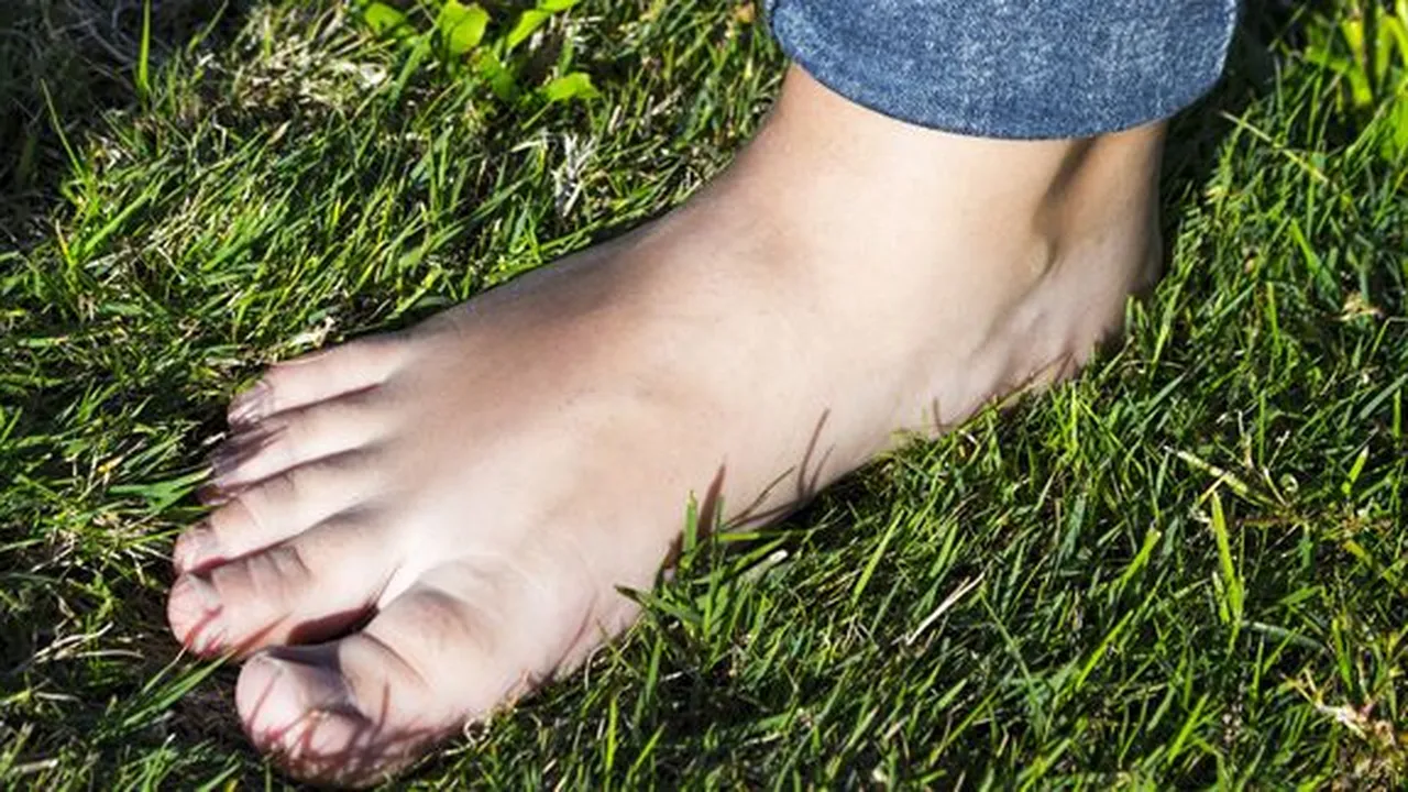 5 Cara Mengatasi Kuku Cantengan di Rumah, Ketahui Juga Penyebab dan Gejalanya