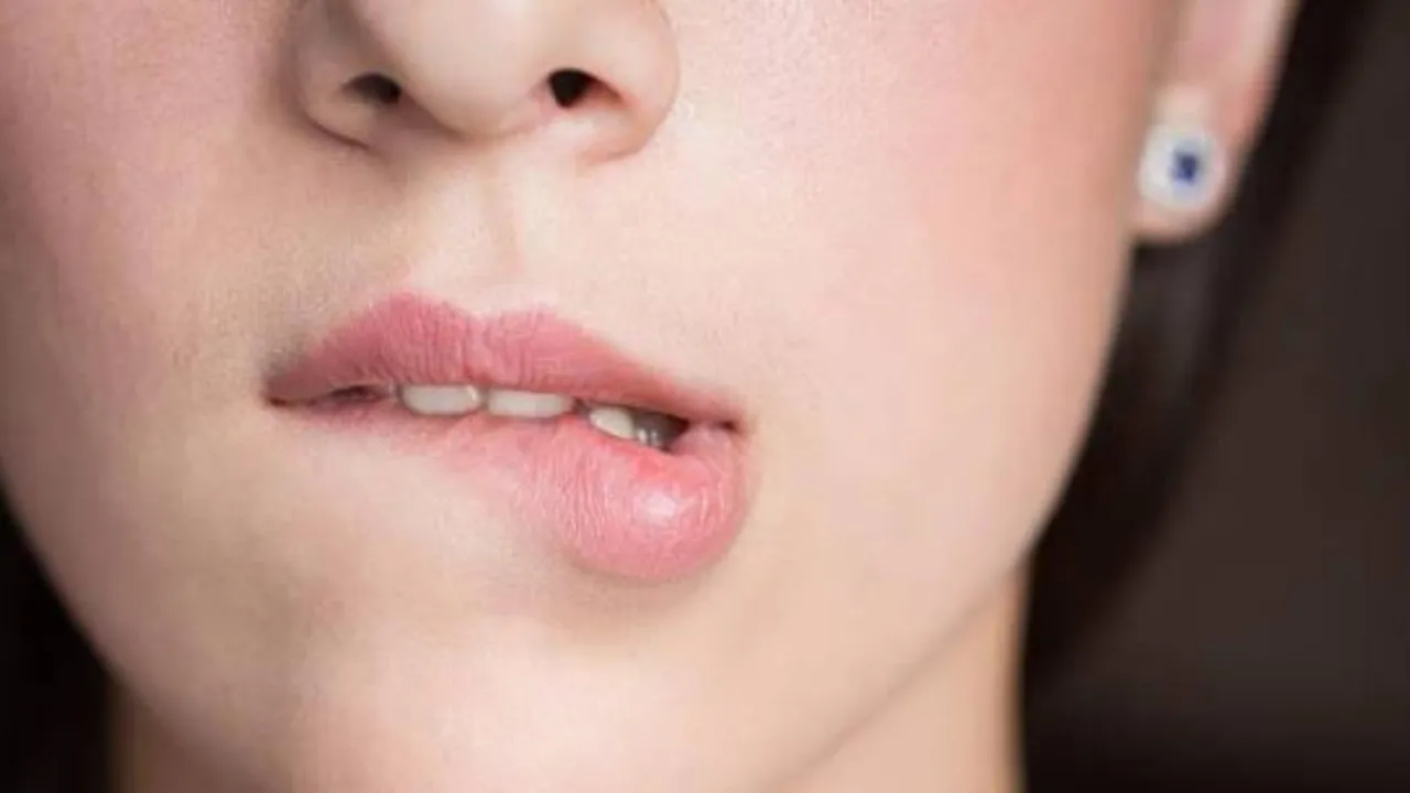 5 Cara Mudah Menjaga Bibir Agar Merah Alami