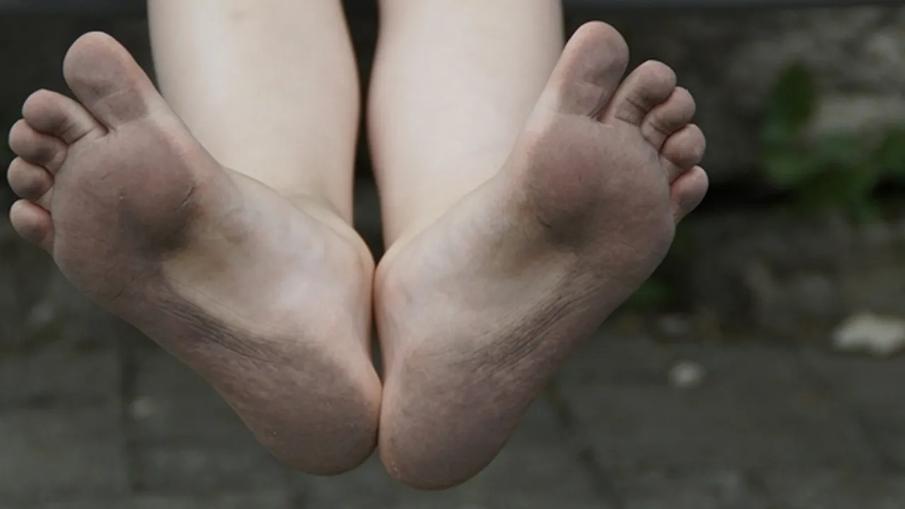 8 Cara Menghaluskan Tumit Kaki yang Kasar dan Pecah-Pecah Secara Alami