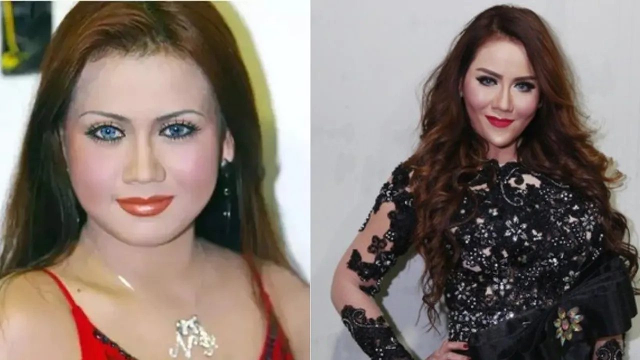 9 Transformasi Artis Sebelum dan Sesudah Lakukan Face Lifting, Langsung Kembali Muda