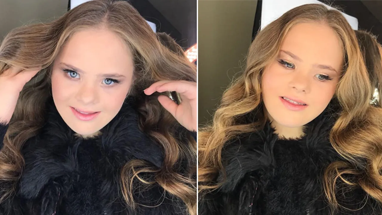 Alami Down Syndrome, Remaja Cantik Ini Jadi Model Hingga Dikontrak 5 Agensi