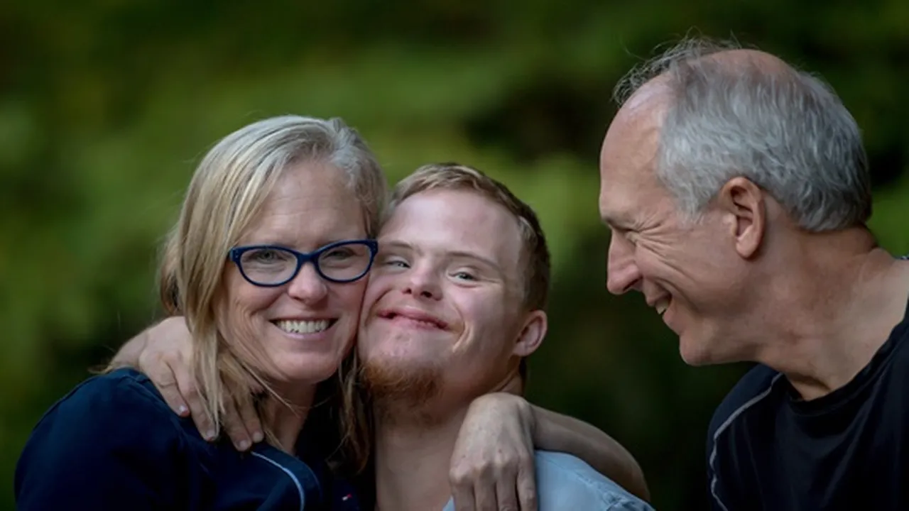 Apa Arti Down Syndrome? Pahami Penjelasan Gejala dan Pengobatannya