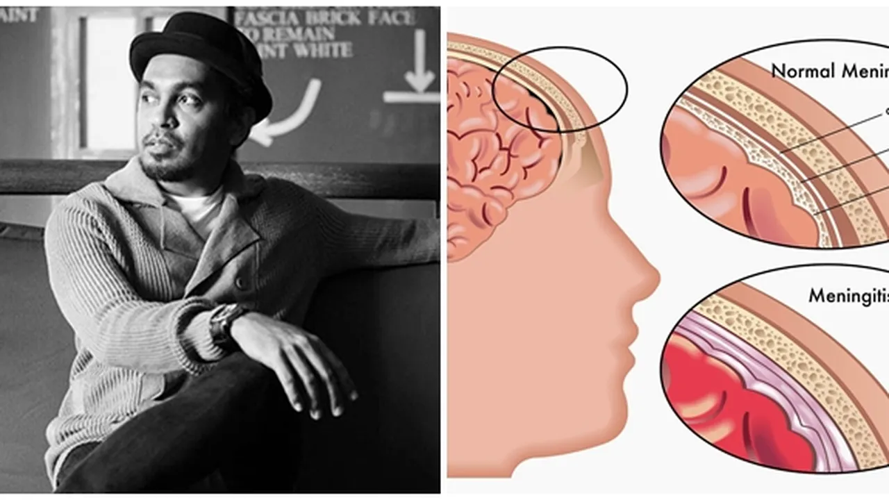 Apa Itu Meningitis? Mengenal Penyakit Yang Merenggut Nyawa Glenn Fredly