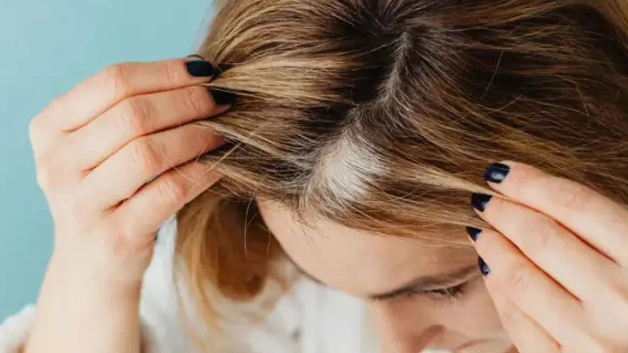 Cara Mengatasi Rambut Pitak dengan Trik Makeup Sederhana, Auto Percaya Diri