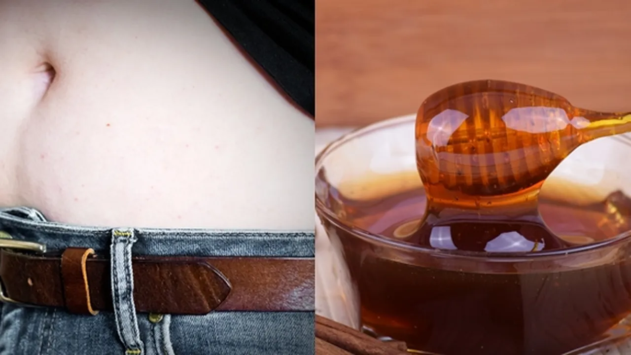 Cara Menghilangkan Stretch Mark Secara Alami dan Juga Praktis