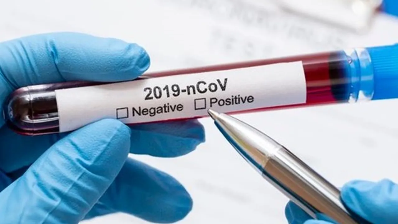 Dapatkah Orang yang Terkena Virus Corona Covid-19 Terinfeksi Kembali?