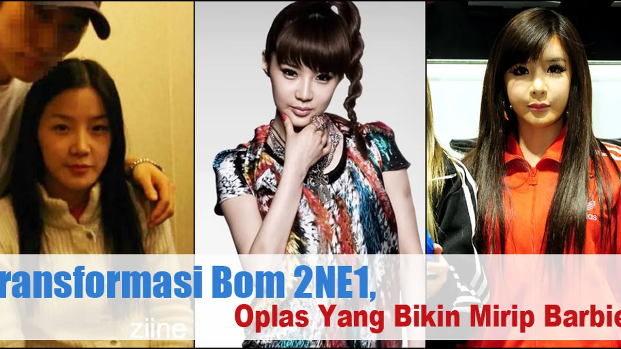 Demi Wajah Mirip Barbie, Bom 2NE1 Oplas?