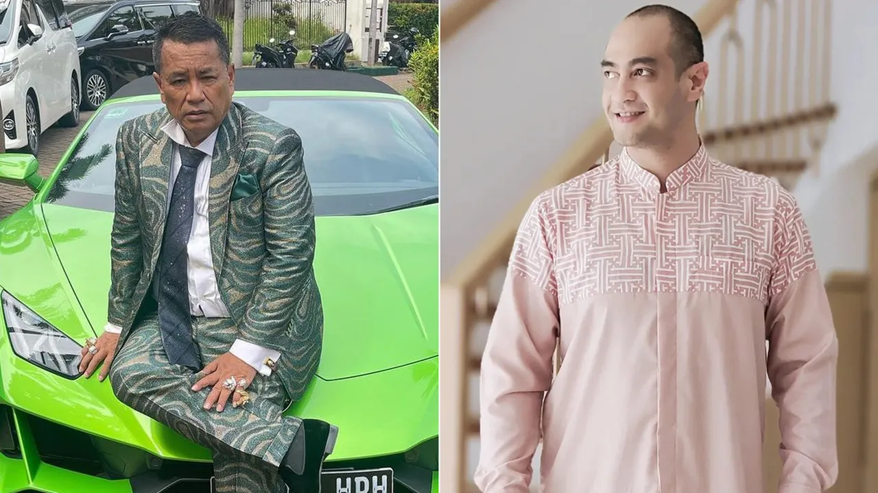 Dengar Kabar Ferry Irawan Pakai Jasa Hotma Sitompul, Hotman Paris: Mereka Cocok