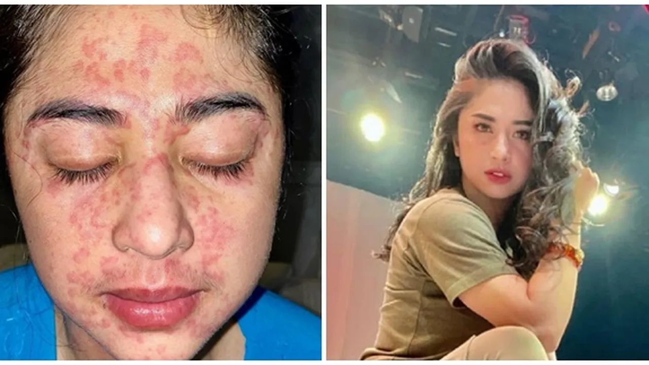Dewi Perssik Beberkan Kronologi Terkena Covid, Ternyata Positif Bersama 8 Orang lainnya