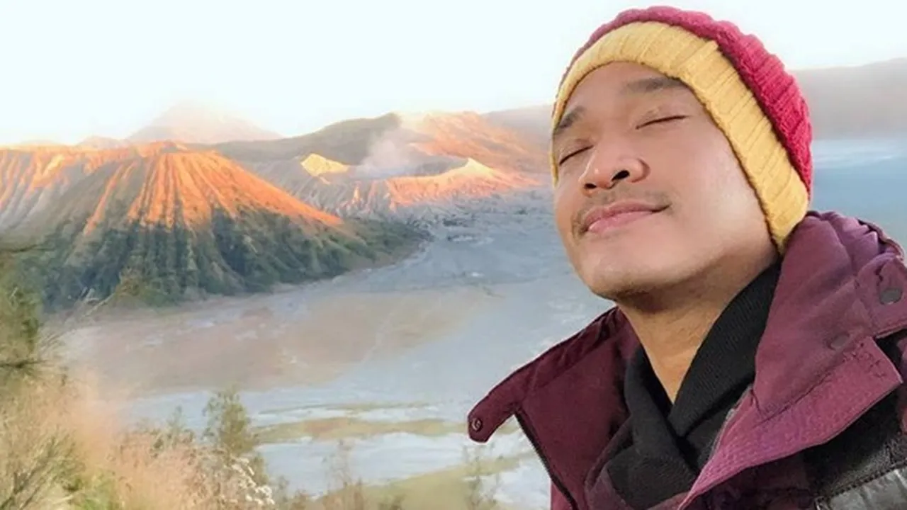 Diberitakan Wajahnya Jadi Hitam, Ini Komentar Ruben Onsu